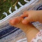 Child's foot at 9 months of age.